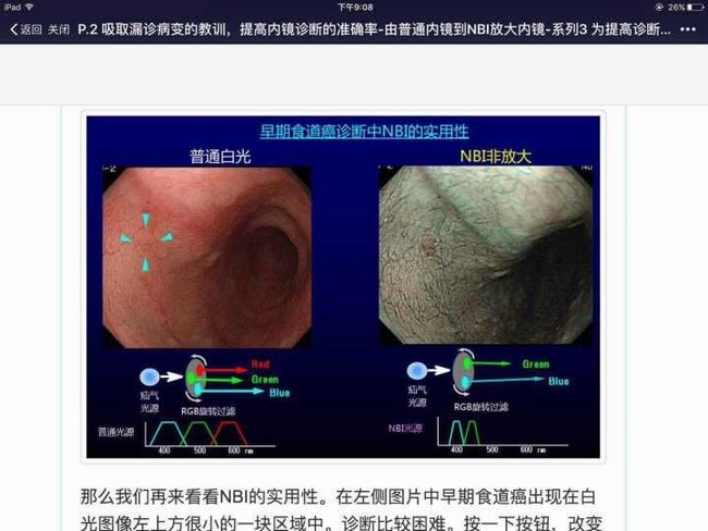 國際一流胃腸內(nèi)窺鏡系統(tǒng)助力我院鏡診療水平更上新的臺階(圖1)